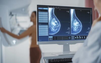 ¿Se puede hacer una mamografía con implantes mamarios?