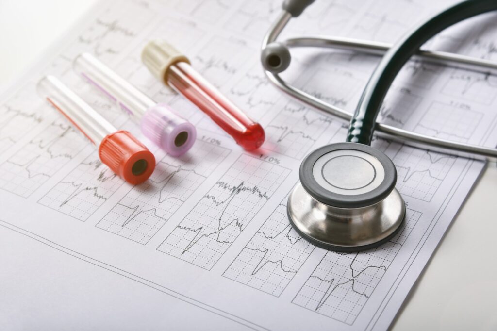 analitica pruebas preoperatorio